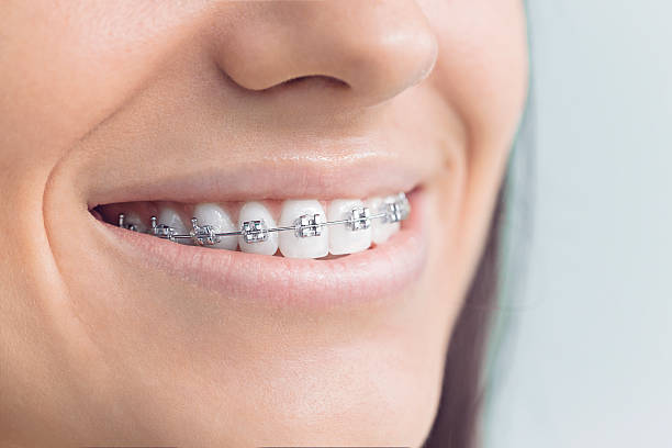 Best Invisalign and Clear Aligners  in Clayton, NJ